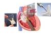 Formation professionnelle en cardiologie - 6 février 2025