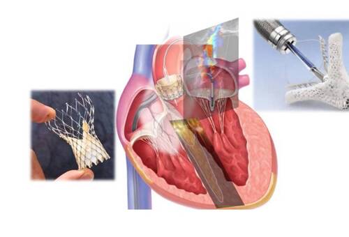 Formation professionnelle en cardiologie - 6 février 2025