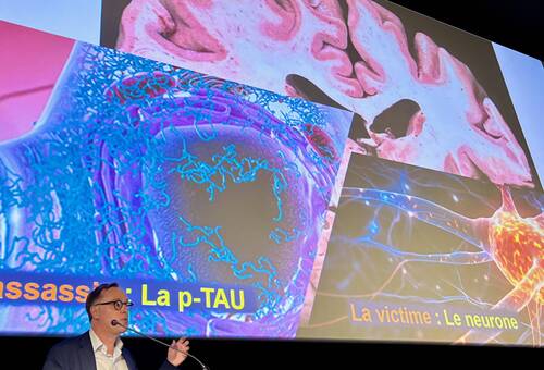 Conférence Alzheimer sept 2025