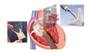 Valves cardiaques