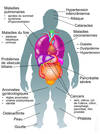 obésité complications