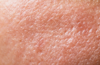 Dermatologie