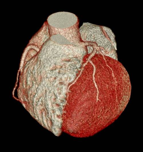 Imagerie cardiovaculaire